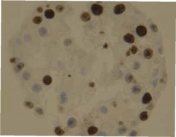 Cells are positive for cell proliferation marker KI67